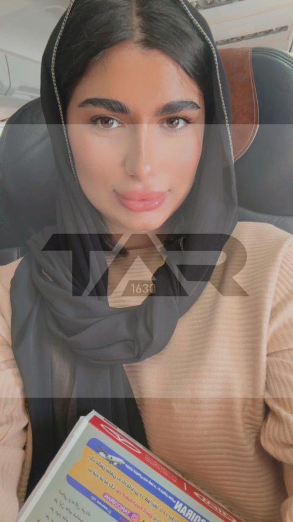 تارکو ایران 30 IMG-20240830-WA0072